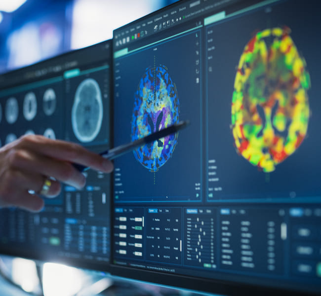 Neuropsicología en Clínica Bupa Santiago