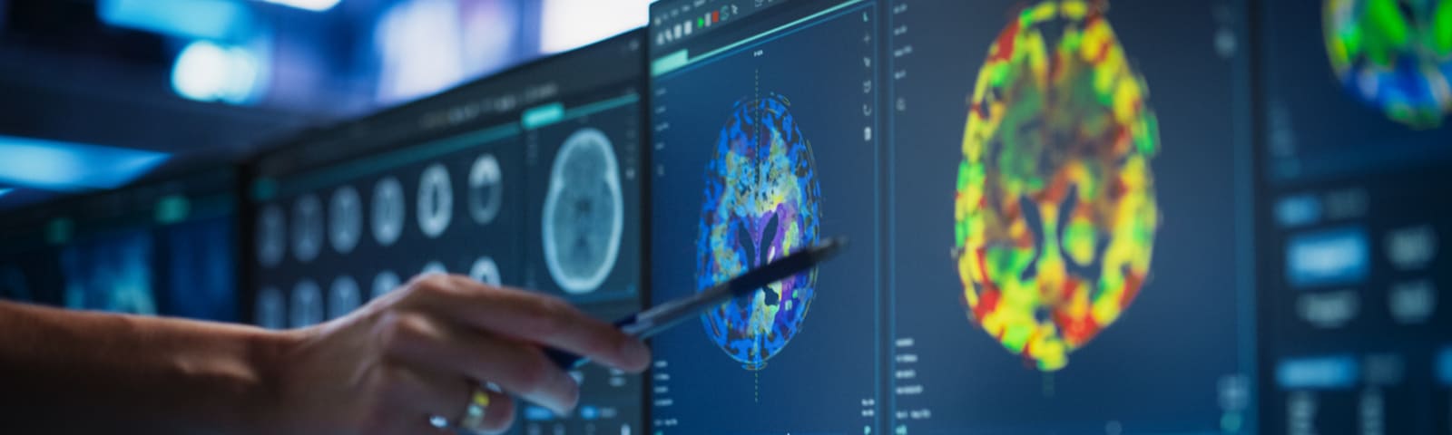 Neuropsicología en Clínica Bupa Santiago