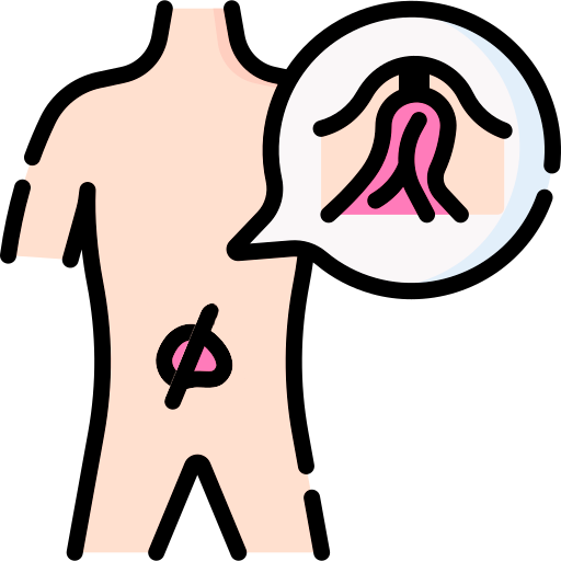 Hernia incisional