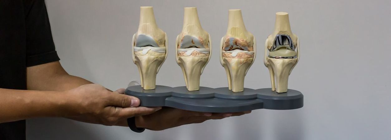Tu cirugía de prótesis de rodilla con SAP Fonasa